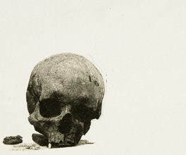 Photographs of Batman's skull.
